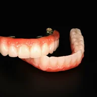 Full-arch All-on-4 implant restoration crafted by Prime Lab Dental Studios