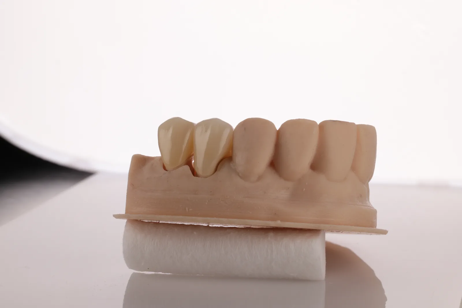 Layered ceramic crown restoration by Prime Lab Dental Studios