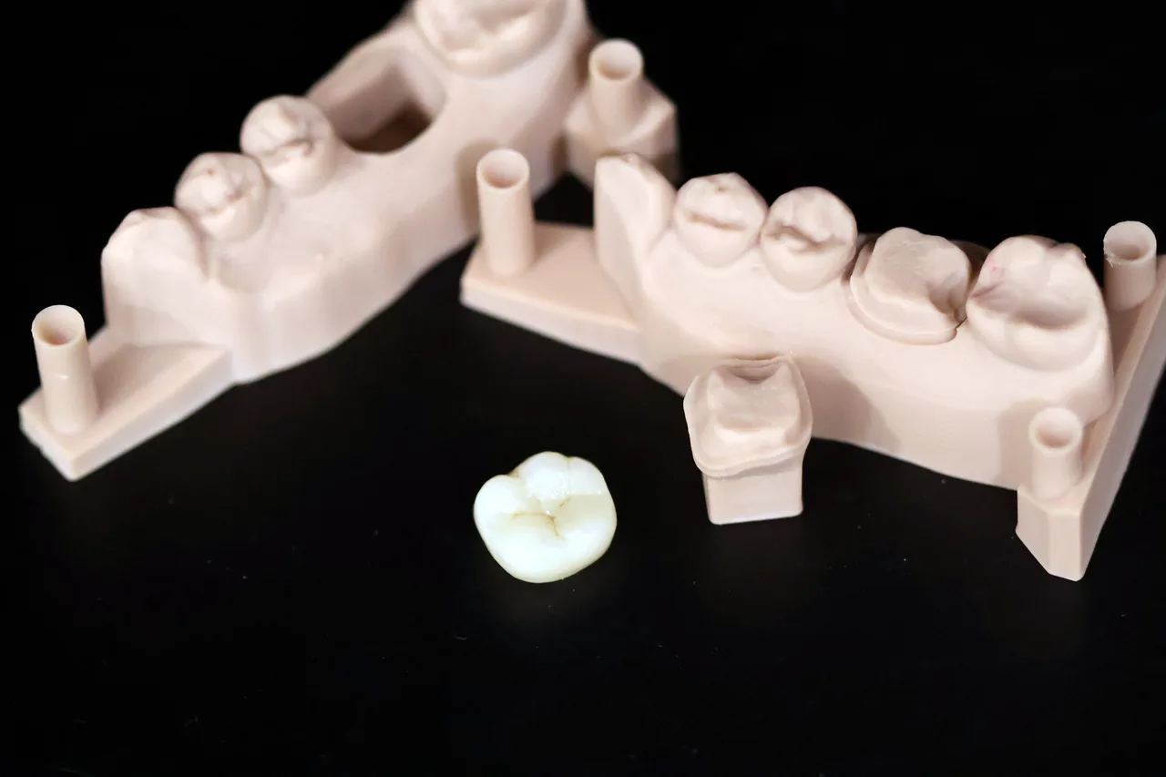 Monolithic E.max crown beside its printed models by Prime Lab Dental Studios