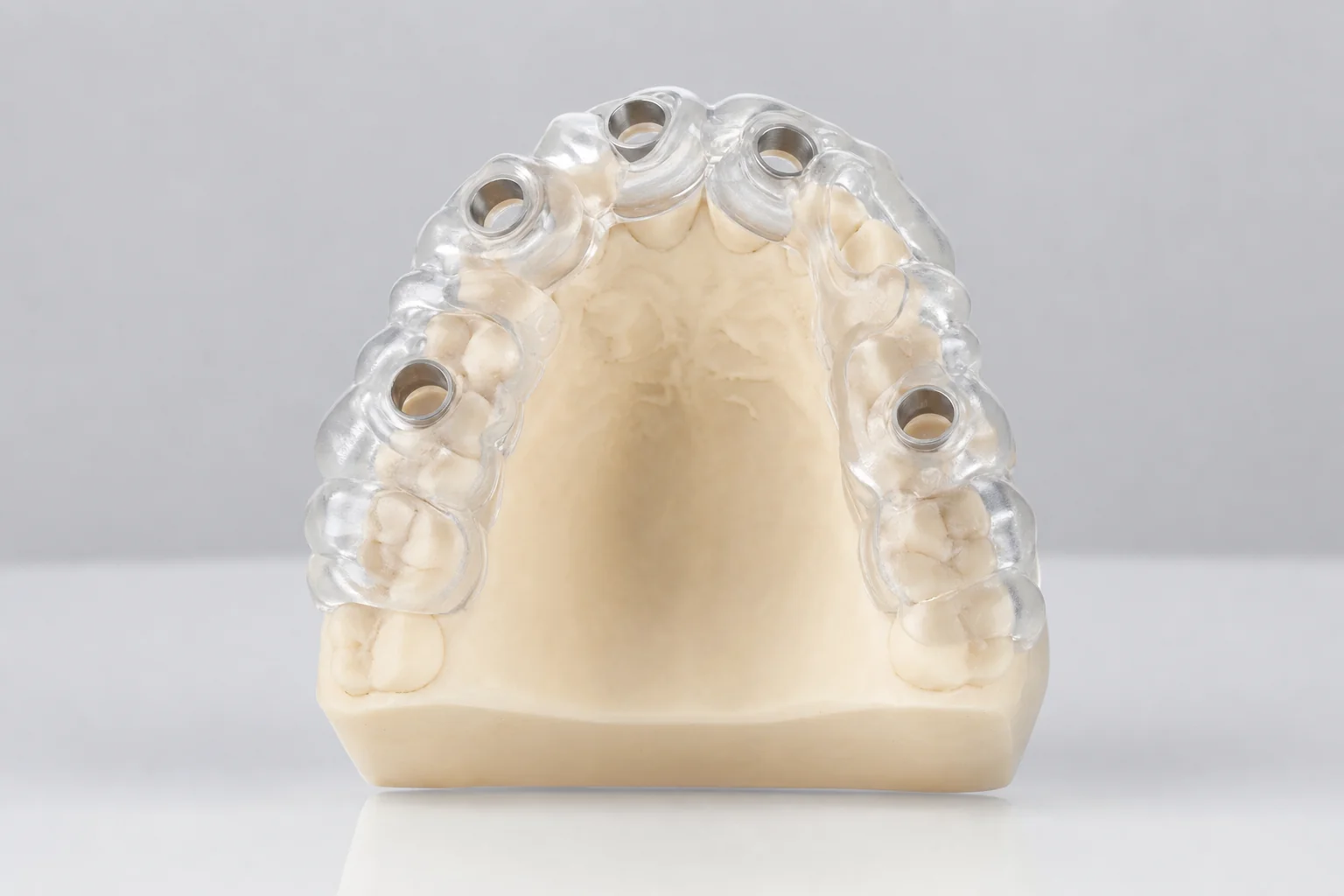 Dental surgical stent by Prime Lab Dental Studios