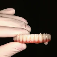 Implant-supported bridge crafted by Prime Lab Dental Studios