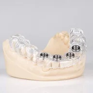 Implant surgical guide on a model, made by Prime Lab Dental Studios