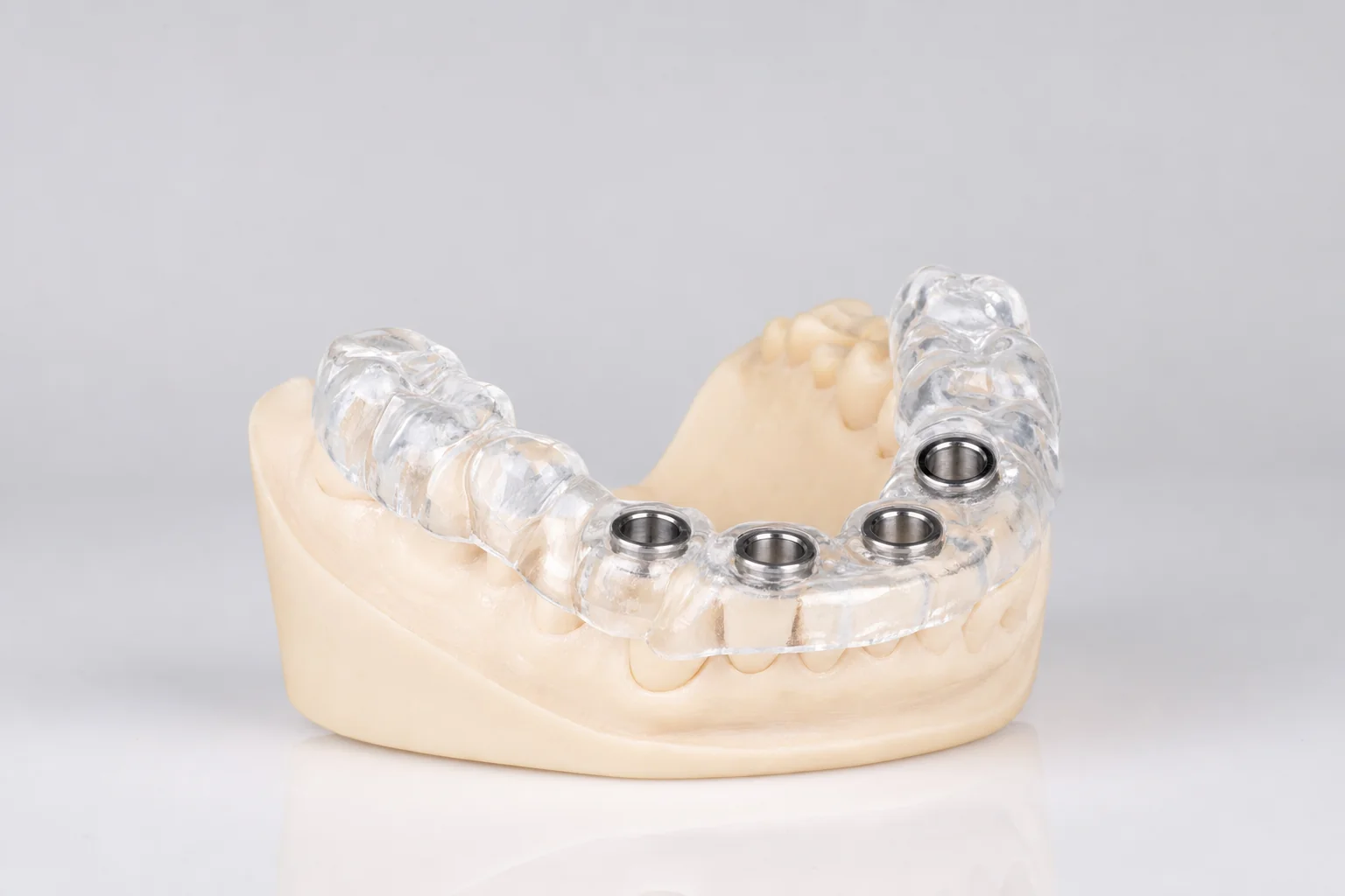 Implant surgical guide by Prime Lab Dental Studios