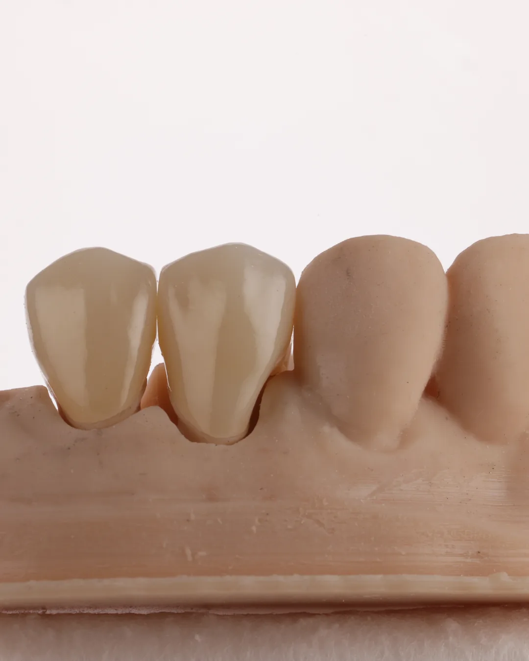 Digital dental planning and design at Prime Lab Dental Studios